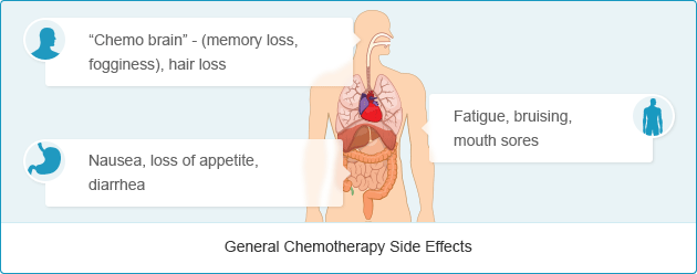 Chemotherapy Side Effects | Mesothelioma Guide Chemotherapy Side Effects | Mesothelioma Guide