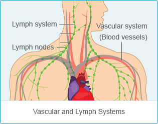 Mesothelioma Metastasis - How To Prevent Cancer Spread