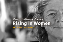 Image of a woman's face. Image reads: Mesothelioma Cases Rising in Women Around The World