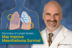 "Discovery of Lymph Nodes May Improve Mesothelioma Survival" - Dr. Joseph Friedberg with illustration of lungs affected by mesothelioma
