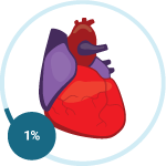 Pericardial Mesothelioma